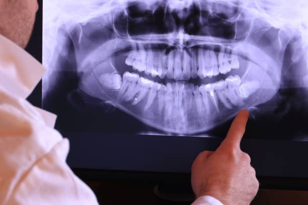 Best Emergency Treatment for Toothache in Sibley, LA