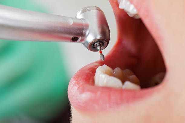 Best Pediatric Emergency Dentist in Sibley, LA